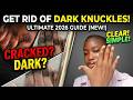 GET RID OF DARK KNUCKLES EASILY IN 2026 | The truths nobody is talking about| watch to the end.