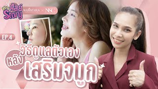 วิธีการดูแลตัวเองหลัง เสริมจมูก ฉบับ NSC CLINIC I สร้างศัลย์ Story I EP.4