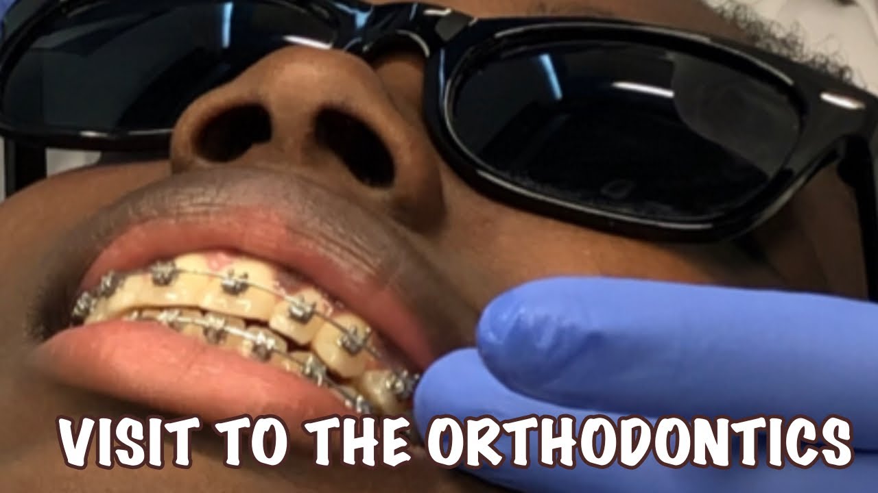 Braces Vlog |orthodontics #braces #teeth - YouTube