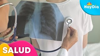 Enfisema pulmonar, ¿Qué es y cuáles son sus síntomas? | Hoy Día | Telemundo