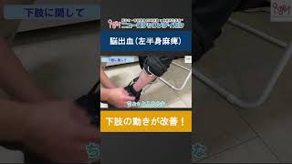 【本編は関連動画】脳出血で左半身麻痺になられた患者様の下肢の動きの改善の様子【再生医療＋リハビリ】 #脳出血 #左半身麻痺 #幹細胞点滴 #再生医療