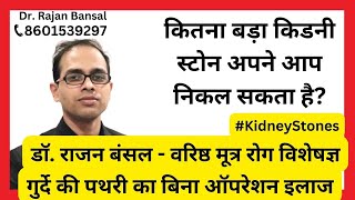 Kidney stone size you can pass at home | Non- Surgical Treatment of Kidney Stones | Dr. Rajan Bansal
