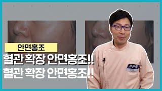 [건강365] 혈관 확장 안면홍조!! / 류병직 원장 / 051-746-6345)