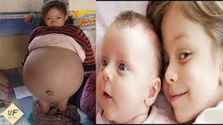 The YOUNGEST Mothers In The World. Youngest Parents  Ever Exist. Real Life Story. Heartbreaking 😞