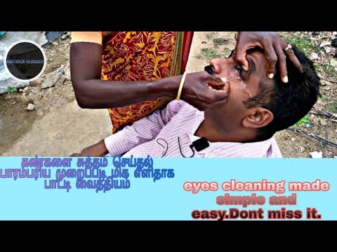 Cleaning the Eyes Makes It Simple Cleaning the Eyes Makes It Simple
