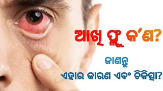 ଆଖି ଫ୍ଲୁ କ’ଣ? ଜାଣନ୍ତୁ ଏହାର କାରଣ ଏବଂ ଚିକିତ୍ସା? #odiafact #therealfacticity #eyeflu #eyeflutreatment