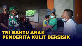 TNI Salurkan Bantuan Untuk Bocah Kulit Bersisik