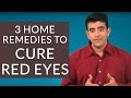 3 Effective Home Remedies To GET RID Of RED EYES 3 Effective Home Remedies To GET RID Of RED EYES