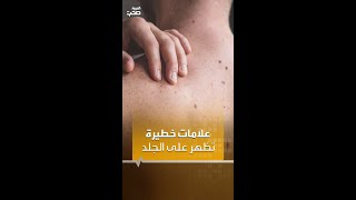 علامات خطيرة تظهر على الجلد