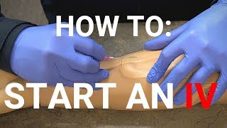 How To Start An IV