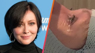 Shannen Doherty's Cancer Spreads to Her Brain