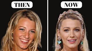 Blake Lively’s NEW LOOK | Plastic Surgeon Reacts