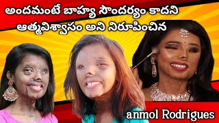 అందమంటే బాహ్య సౌందర్యం కాదని ఆత్మవిశ్వాసం అని నిరూపించిన  Anmol Rodrigues