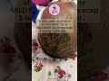 How to get rid of CRADLE CAP on baby's scalp naturally