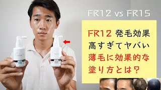 【フォリックス】FR12とFR15を比較して最強の発毛剤を決めてみた。FR12の効果と使い方！