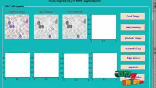 Final Year Projects | A novel method of white blood cell segmentation