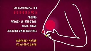 სარძევე ჯირკვლის შეფასება ასაკისა და სქესის შესაბამისად