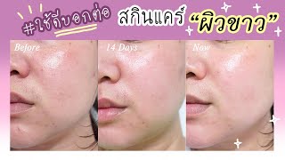 ผิวหมองคล้ำ หน้าไม่ขาวใส มาทางนี้ #ใช้ดีบอกต่อ รีวิวสกินแคร์ Cute Press Alpha Bright New Collection✨