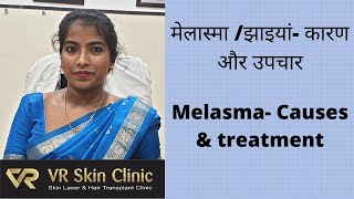 मेलास्मा /झाइयां- कारण और उपचार| Melasma- Causes & Treatment| Dr Rekha, VR Skin Clinic, Bikaner
