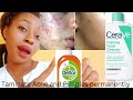 How to clear Acne and pimples very fast with Dettol and CeraVe foaming cleanser#acne#glassskin