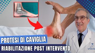 PROTESI DI CAVIGLIA RIABILITAZIONE POST INTERVENTO | Dott. Andrea Scala