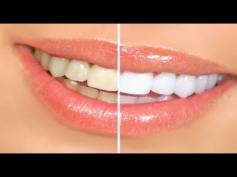 Beauty Tips - Simple Steps For At Home Teeth Whitening - Beauty Tips ...