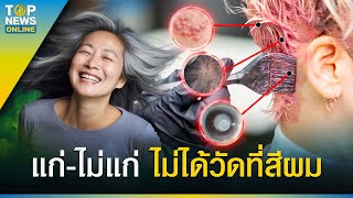 'กรมการแพทย์' เตือน หนุ่ม-สาว ย้อมผมปิดหงอกทุกเดือน ต้องระวัง? | EVERGREEN