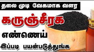 தலைமுடி உதிர்வுக்கு தீர்வு தரும் கருஞ்சீரக எண்ணெய்! black cumin seeds for Hair loss