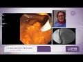 ameg 2023 live erc stone extraction