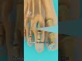 what is hammer toe and how to fix it shorts viralvideo creativelearning3d