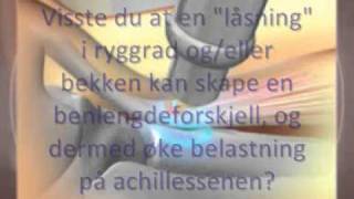 Trykkbølgebehandling achilles (naprapat Fredrikstad)