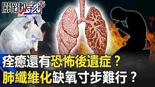 痊癒還有恐怖後遺症！？肺纖維化致命「結節」缺氧猛喘寸步難行！？ 【關鍵時刻】20200221-6劉寶傑 馬西屏