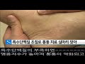 실큐 아미노산으로 통풍치료 굿모닝월드 실크아미노산 당뇨치료