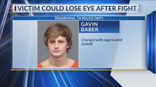 Suspect behind bars after gouging man's eye during fight in Texarkana