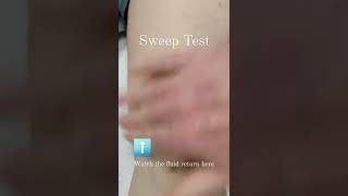 Aclr Rehab Sweep Test
