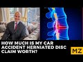 How Much Are Herniated Disc Injury Cases Worth?  Understanding the Settlement Value of Your Claim.