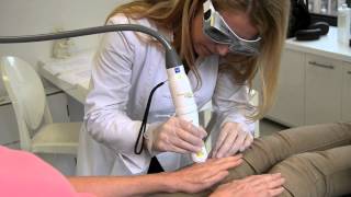 Fractional Laser Resurfacing at Russak Dermatology Clinic