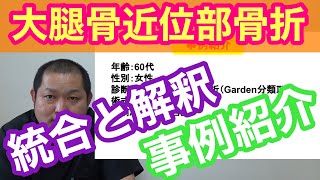 【事例紹介】新人理学療法士必見！大腿骨近位部骨折患者さんのプログラム立案について