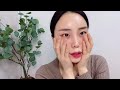 vlog 오타모반q u0026a 오타모반치료 오타모반 완치 오타모반 치료후기 🧡