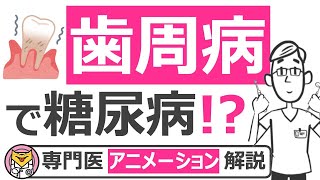 血糖値が上がる口の中の病気!?【10分で糖尿病専門医がアニメーション解説】