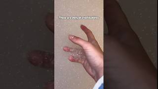 Let’s make dehydrated bubbles 🫧