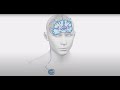 Deep Brain Stimulation (DBS) for Parkinson’s Disease, Essential Tremor, and Epilepsy