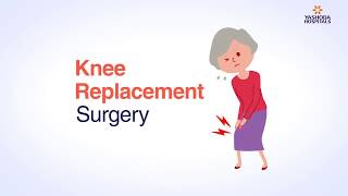 Knee Replacement surgery procedure | Things you need to know