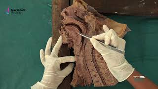 H N Part 1 Mid Sagittal Section