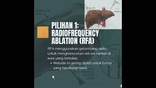 Hepatitis  Pilihan Terapi untuk Hepatoma  Menentukan Pengobatan yang Tepat #hepatitis #hepatoma