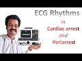 All the ECG Rhythms in Cardiac Arrest and Periarrest scenarios