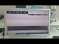 brake dynamo test 3