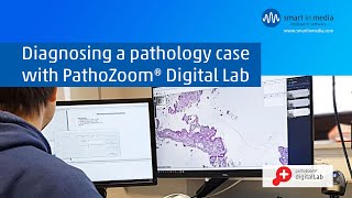 Diagnosing with PathoZoom Digital Lab