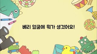 💙베리 얼굴에 뭐가 생겼어요!!️/도리스돌30(버니)/베리/관절인형/스토리/점(.)