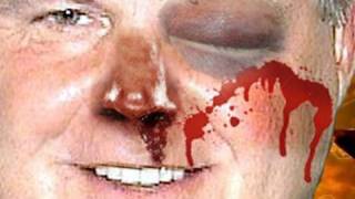 Punch Rush Limbaugh!! Rush Gets Owned!